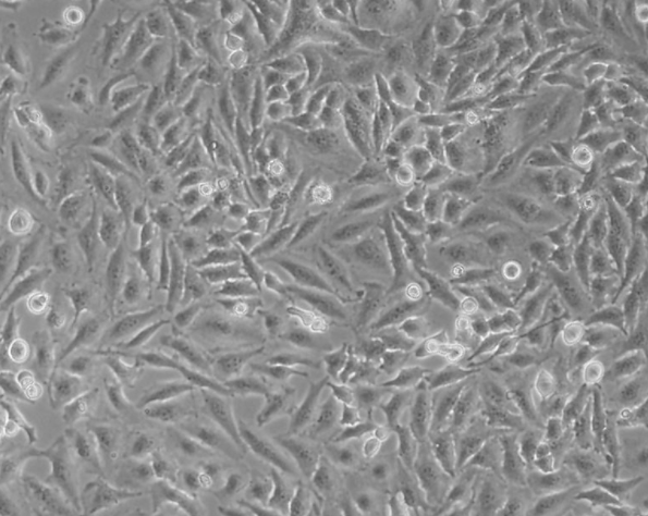Hela人宫颈癌细胞（通过STR鉴定）